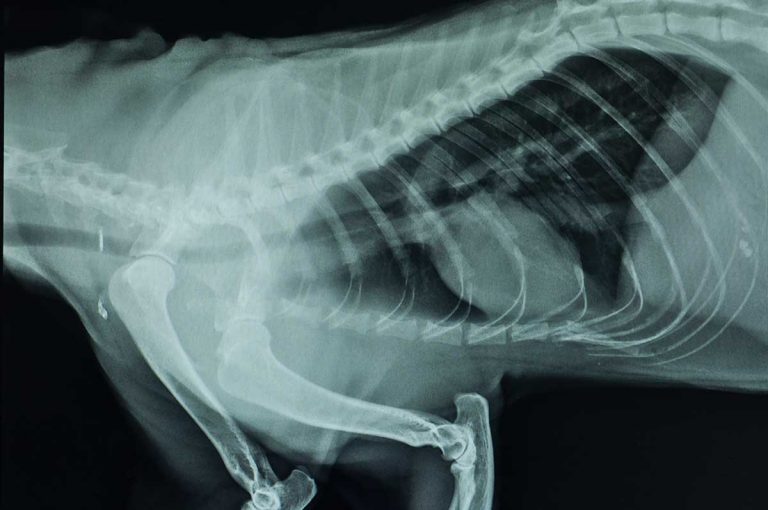 Artificial intelligence powers new X-ray software