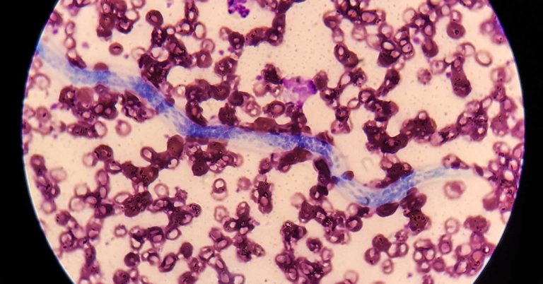 New Orleans to Host Fall Heartworm Symposium