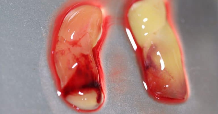 Enso launches 30-minute regenerative medicine kit