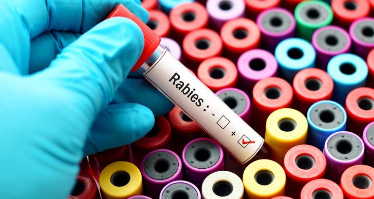 What are you doing on World Rabies Day?