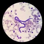 canine heartworm