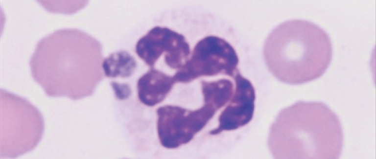 Using Antech’s Contextualized Vector-Borne Disease Diagnostics to Confirm Anaplasmosis
