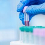 veterinary lab blood in a tube
