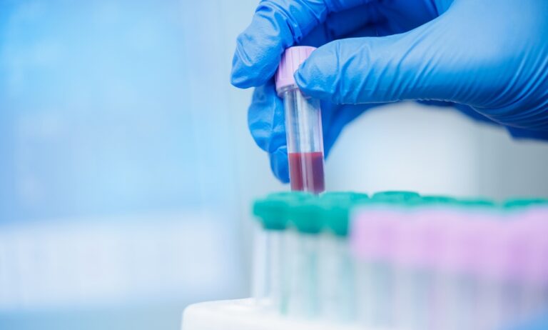 Parasight System and B&L Reference Laboratory Partner